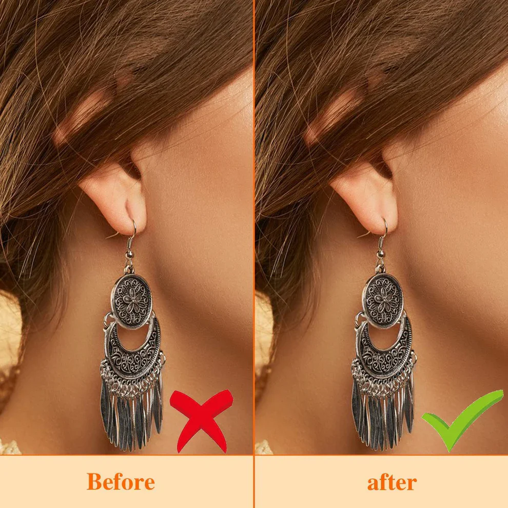 Earlobe Support Patches – Invisible Protection for Your Ears (100 pcs)-.g - Image 2